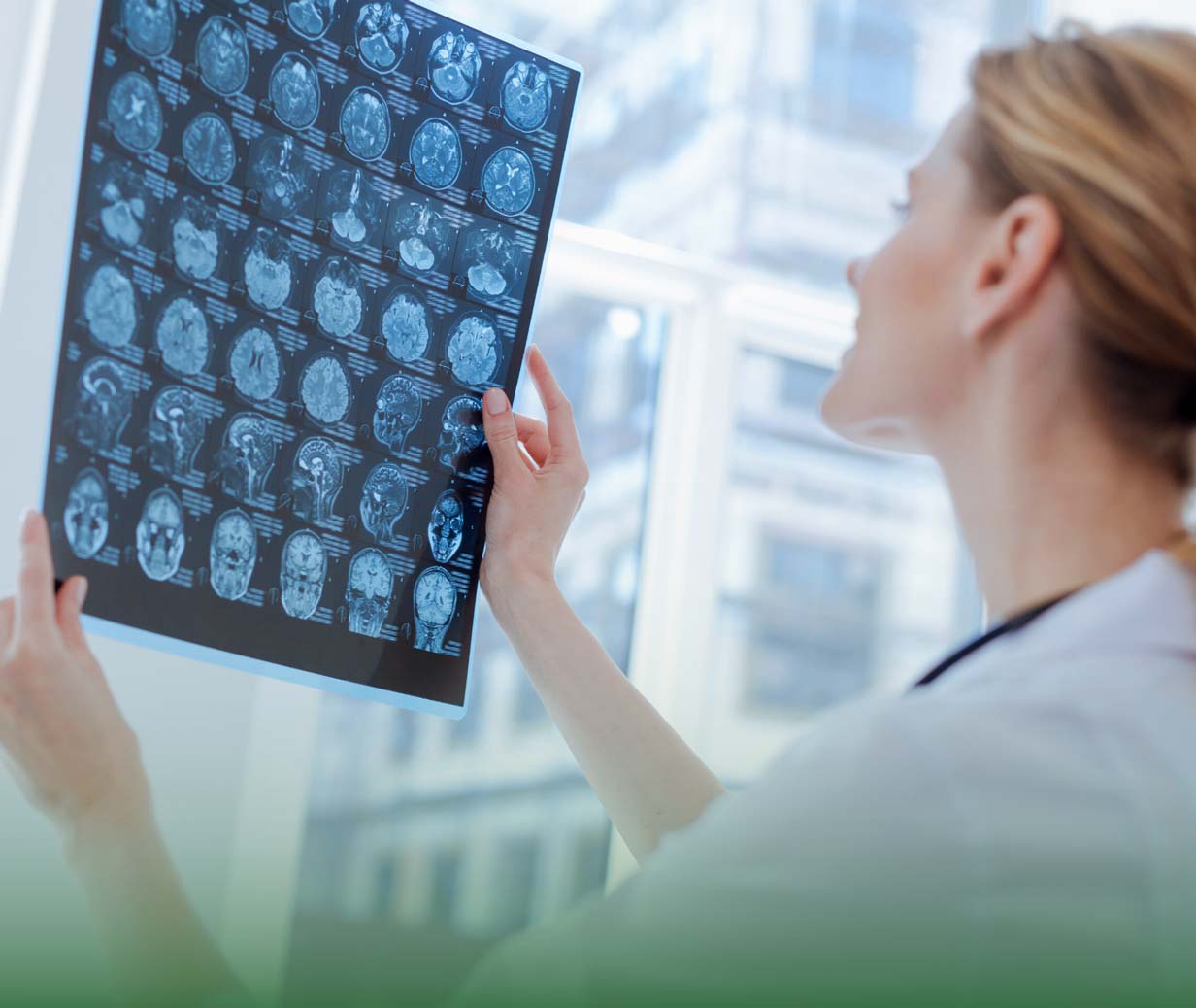 Neurologijos paslauga